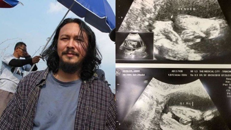 Last Sunday, October 27, Baron Geisler finally announced that he is going to be a father! Know more about the story by scrolling down below!